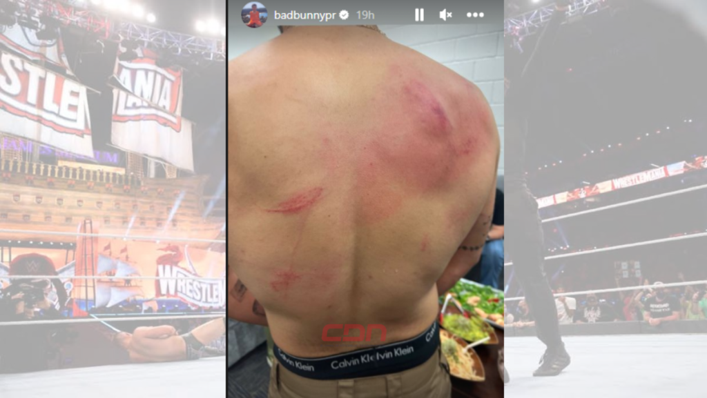 Bad Bunny muestra su espalda con arañazos y hematomas tras pelea en la WWE