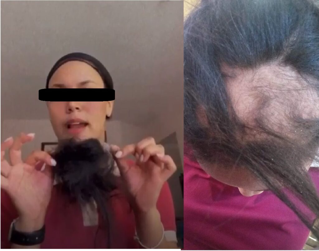 Imponen arresto domiciliario a una adolescente que le arrancó el cabello a otra